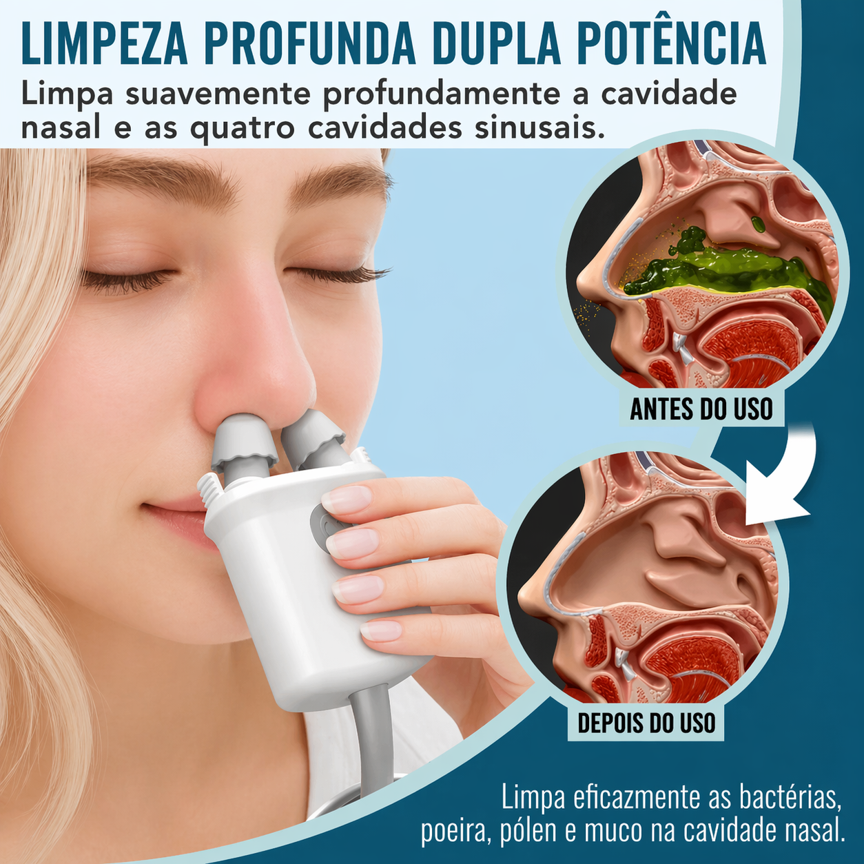 Sistema De Irrigação Nasal Nasalfresh Md Com 30 Pacotes De S